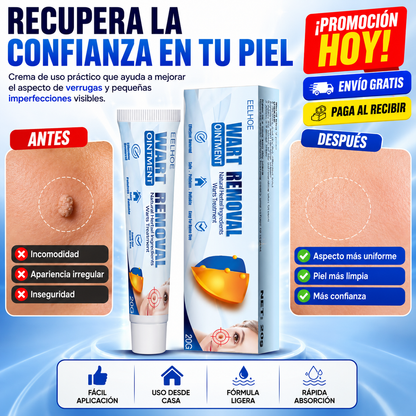 Wart Removal™ Crema para Verrugas y Limpieza Visible de la Piel